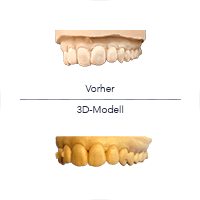 Simulation des Behandlungsziels mit 3D-gedrucktem Modell